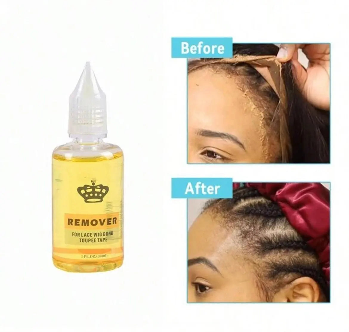 Lace Glue Remover Fast Acting Wig Glue Remover For Lace Wig Removes Hair Glue - Labelle Boutique Hair